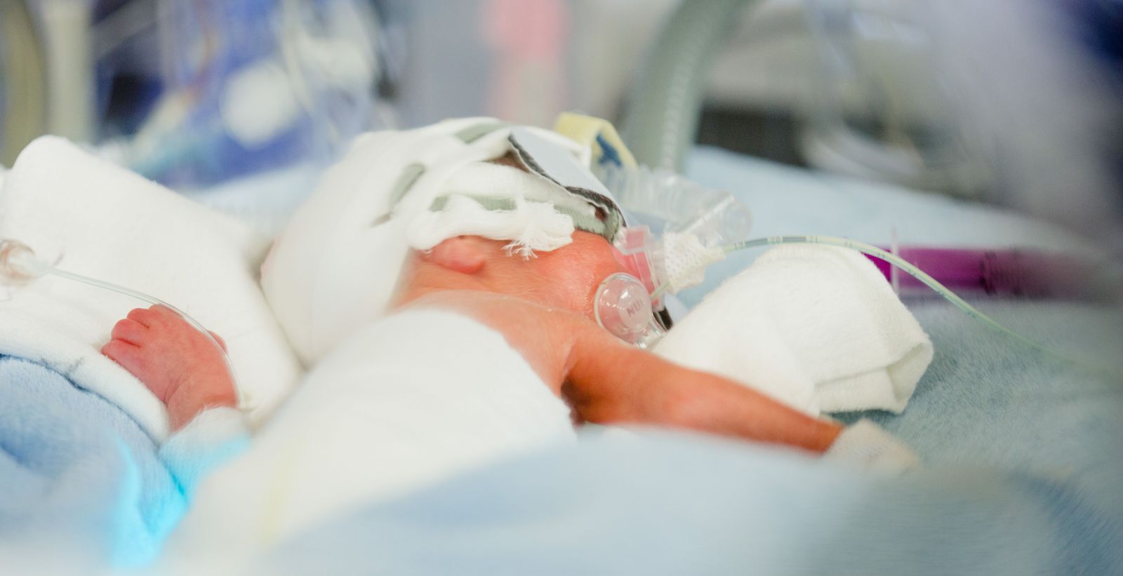Zdjęcie wprowadzające do oddziału neonatologii